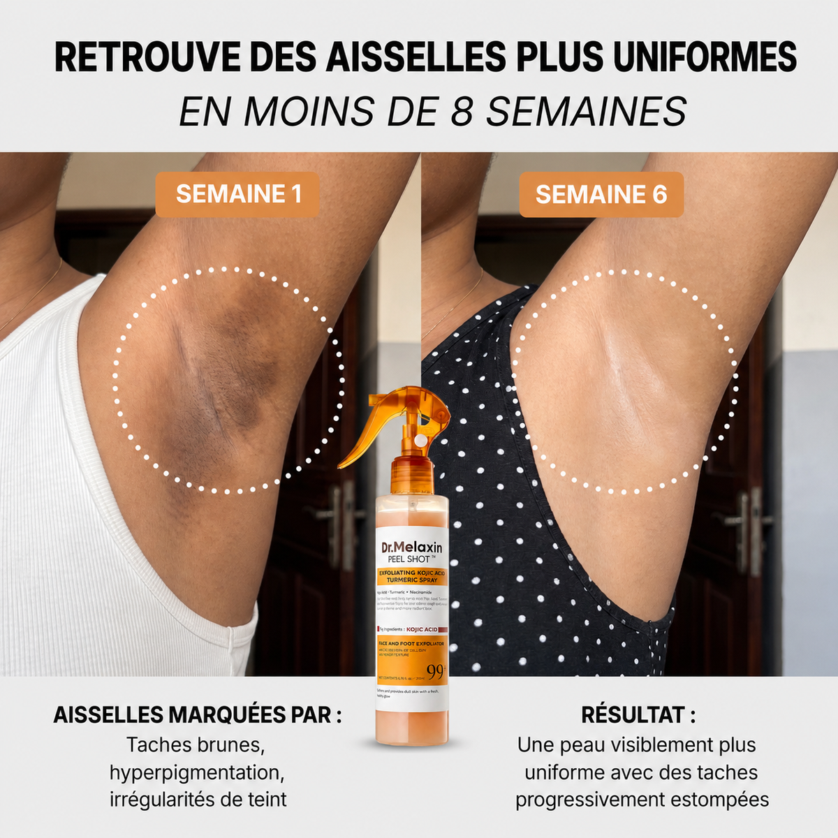 Spray Anti-Taches Aisselles 2