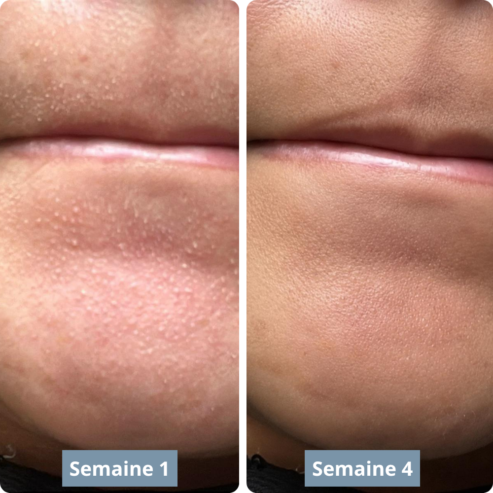 Exfoliant au riz : Élimine tes imperfections et lisse ta peau