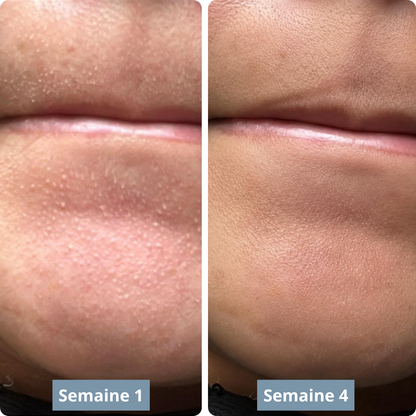 Exfoliant au riz : Élimine tes imperfections et lisse ta peau