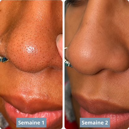 Exfoliant au riz : Élimine tes imperfections et lisse ta peau