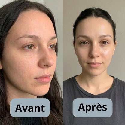 Exfoliant au riz : Élimine tes imperfections et lisse ta peau
