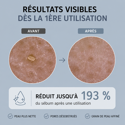 Exfoliant au riz : Élimine tes imperfections et lisse ta peau