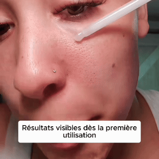 Exfoliant au riz : Élimine tes imperfections et lisse ta peau