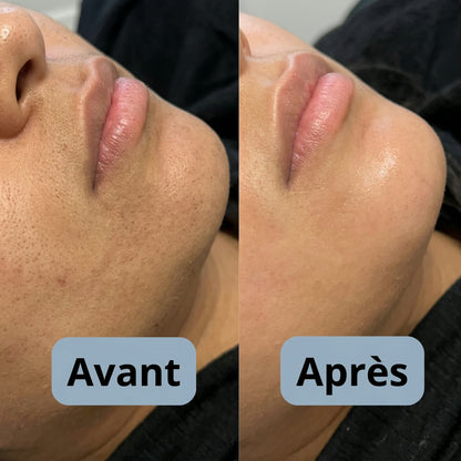 Exfoliant au riz : Élimine tes imperfections et lisse ta peau