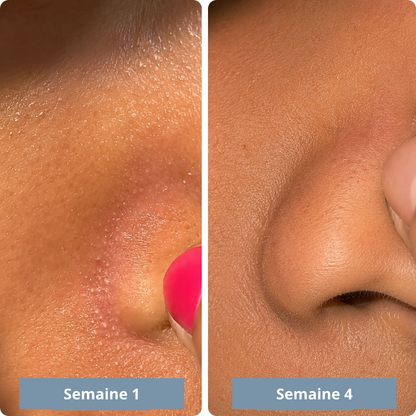 Exfoliant au riz : Élimine tes imperfections et lisse ta peau