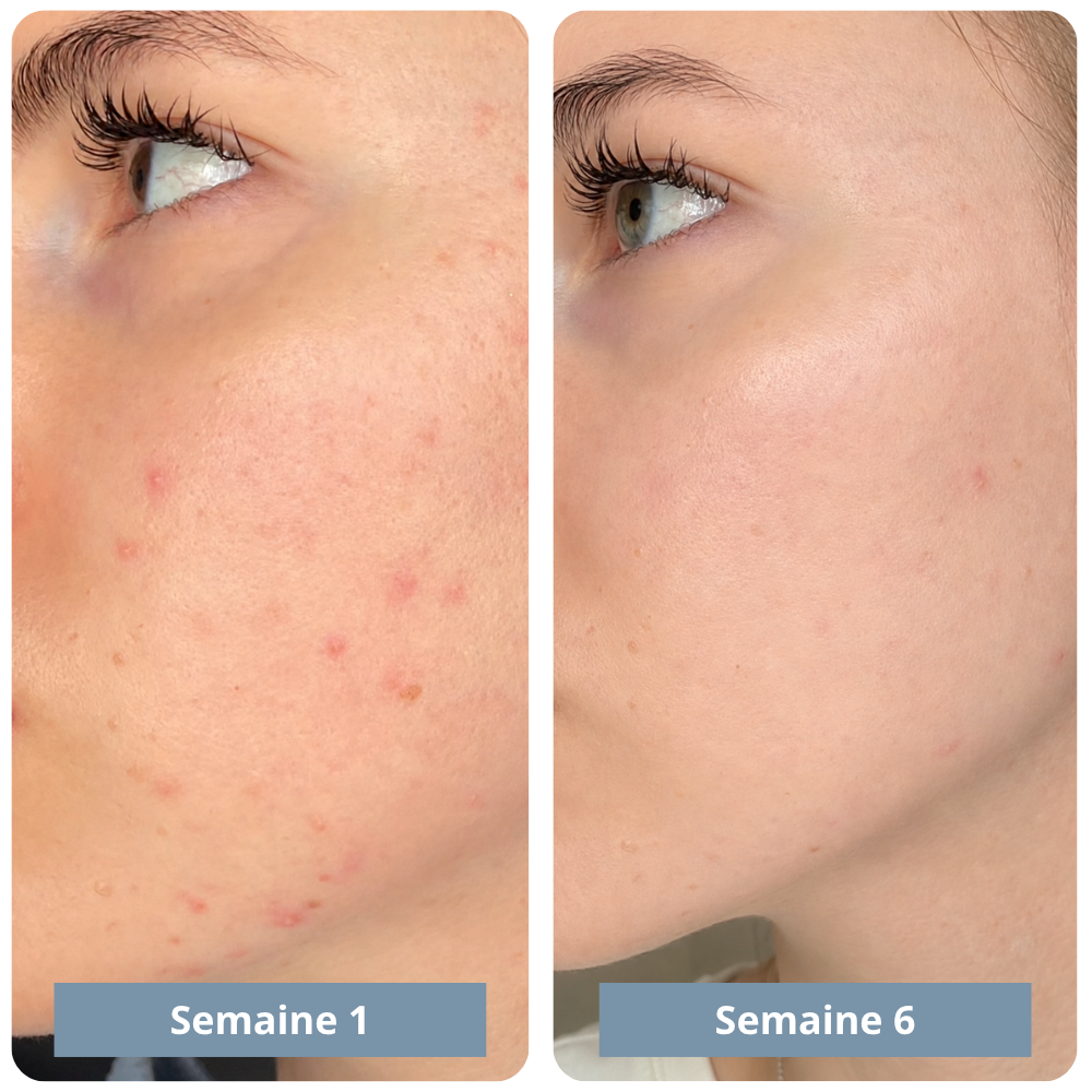 Exfoliant au riz : Élimine tes imperfections et lisse ta peau