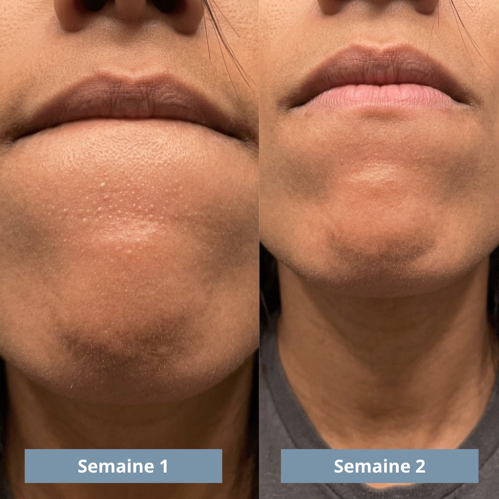Exfoliant au riz : Élimine tes imperfections et lisse ta peau