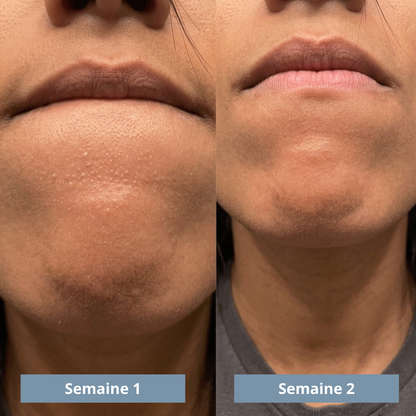 Exfoliant au riz : Élimine tes imperfections et lisse ta peau
